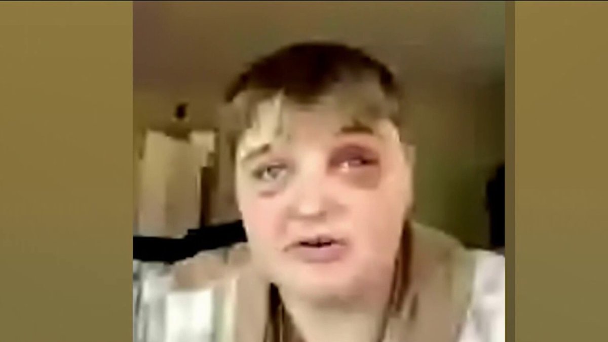 Teen Attacked At McDonald's: Hate Crime?