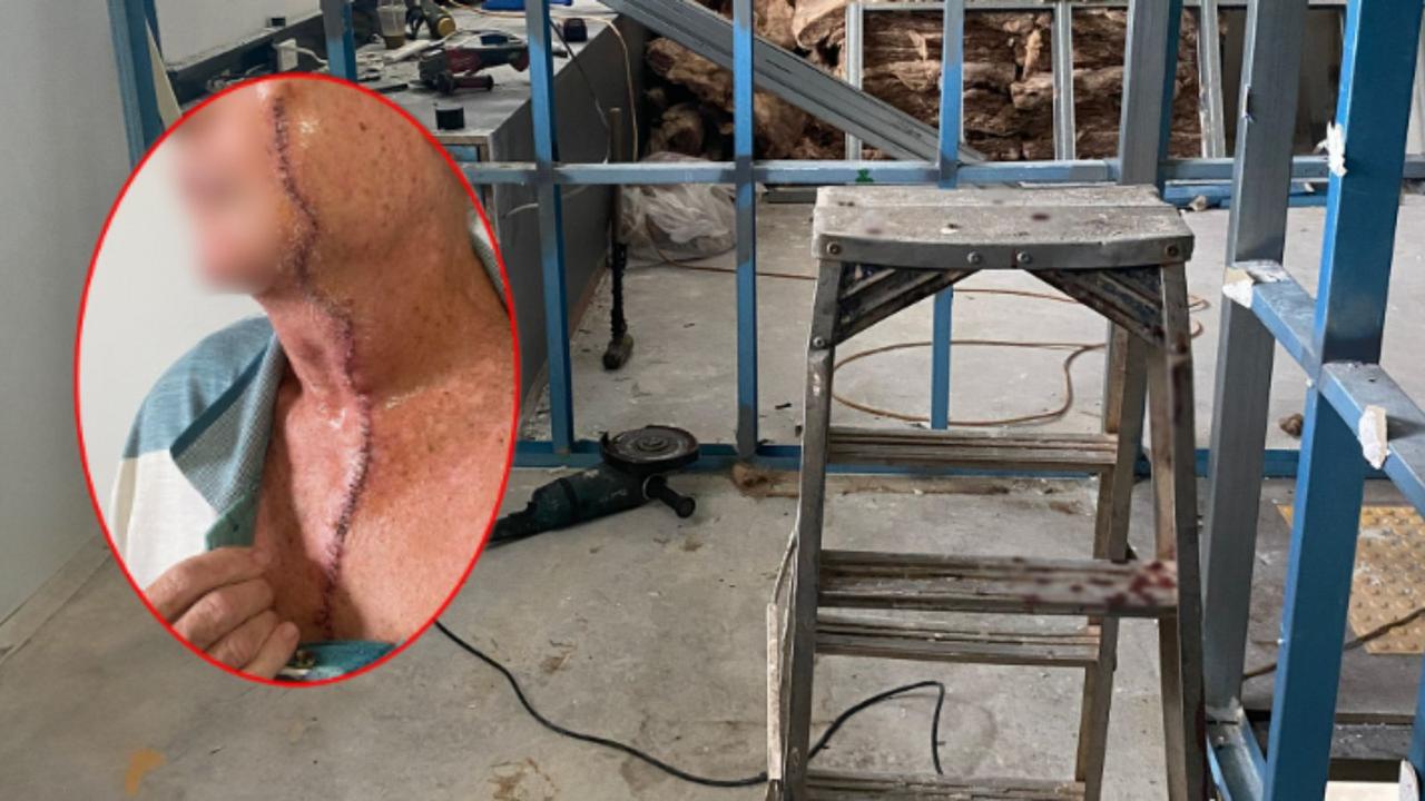 Tradie's Face Attacked: Angle Grinder Assault
